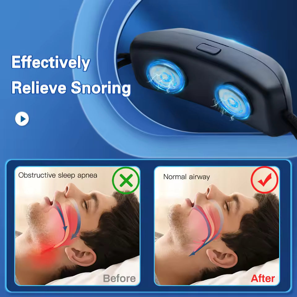 EMS Pulse Anti-Snoring Device